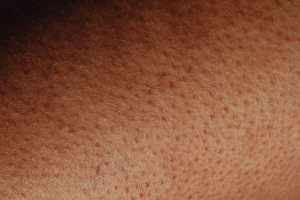 Vitamin-B6-Mangel bei Vegetariern: Ursachen, Symptome und pflanzliche Lösungen