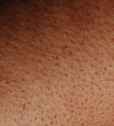 Vitamin-B6-Mangel bei Vegetariern: Ursachen, Symptome und pflanzliche Lösungen