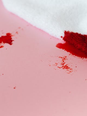 Vitamin-K-Mangel bei Vegetariern: Ursachen, Symptome und pflanzliche Lösungen