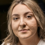 Jodmangel bei Vegetariern: Ursachen, Symptome und pflanzliche Lösungen