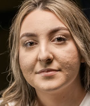 Zinkmangel bei Vegetariern: Ursachen, Symptome und pflanzliche Lösungen